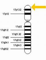 Image result for Canavan Disease Chromosome
