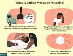 Image result for Carbon Monoxide Poisoning