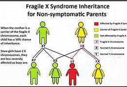 Image result for Fragile X Syndrome Family