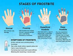 Image result for Getting Frosted