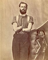 Image result for Civil War Wounded Soldiers