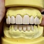 Image result for Dental Wax