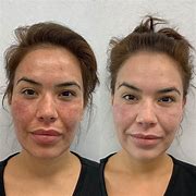 Image result for Fast Skin Care Results with Dr