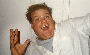 Image result for Chris Farley Face Bruise Movie