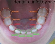 Image result for Nom Des Dents