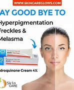 Image result for 10% Hydroquinone Skin Bleaching Cream