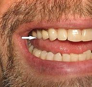 Image result for Dentist Flipper