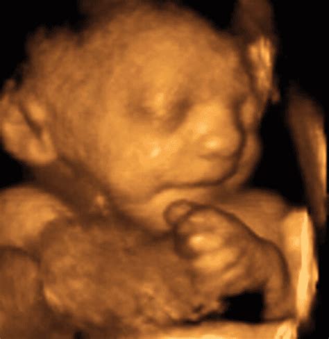 32 weeks and 6 days pregnant   Baby Fetal Progress, Ultrasound  