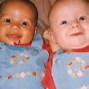 Image result for Rare Biracial Twins