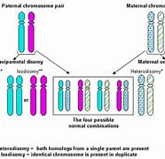 Image result for Chromosome 15 Angelman Syndrome