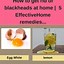 Image result for How to Get Rid of Blackheads Overnight