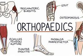 Image result for Orthopaedic
