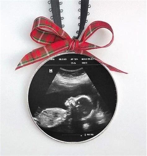 Ultrasound ornament   Baby first christmas ornament, Diy 1st christmas  