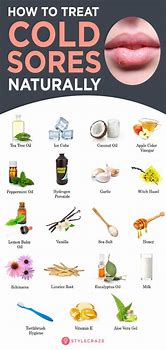 Image result for Natural Cold Sore Remedies