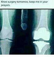 Image result for Knee-Replacement X-ray Joke