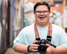 Image result for Down Syndrome Man