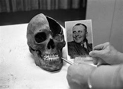 Image result for Martin Bormann Skeleton