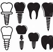 Image result for Dental Implant Clip Art