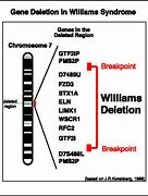 Image result for Williams Syndrome Chromosome