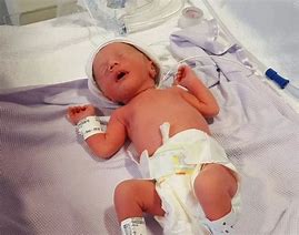 Image result for Baby Born 28 Weeks