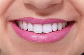 Image result for Dentist Teeth