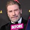 Image result for John Travolta Hairline