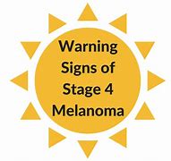 Image result for Signs of Stage 4 Melanoma