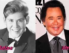 Image result for Wayne Newton Plastic Surgery Before and After
