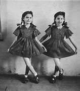 Image result for Mengele Experiments On Twins