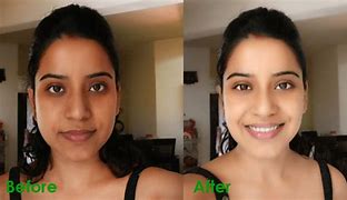 Image result for Before After Skin Lightening Cream