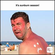 Image result for SunBurn Meme