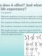 Image result for Trisomy 18 Life Expectancy
