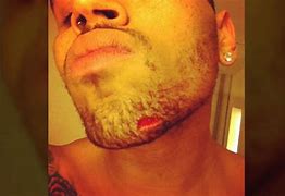 Image result for Chris Brown Rihanna Attack