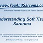 Image result for Sarcoma Cancer Stage 4