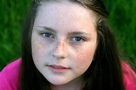 Image result for Portraits with Blemishes