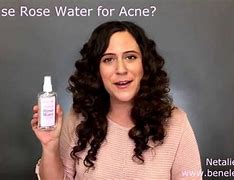 Image result for Rose Water Acne Results