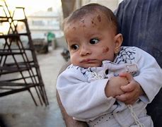 Image result for Syrian Baby