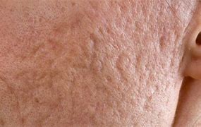 Image result for Vitamin a Skin Results