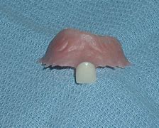 Image result for Dentist Flipper
