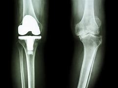 Image result for Orthopedic X-rays