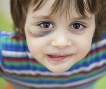 Image result for free pics of child abuse