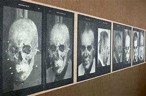 Image result for Josef Mengele Skull