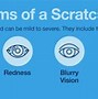 Image result for Scratched Cornea Infected