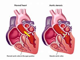 aortic 的图像结果