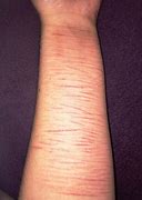 Image result for Healed Battle Scars