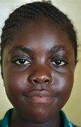 Image result for Black Person Skin Bleaching