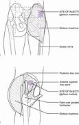 Image result for Muscular Injection Site Chart