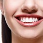 Image result for LED Teeth Whitening