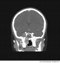 Image result for Tomography Scan