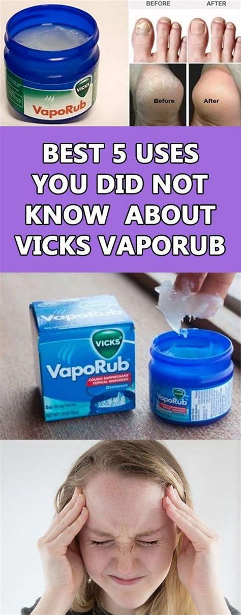 Most Surprising Advantages And Uses Of Vicks VapoRub   Vicks vapor rub  